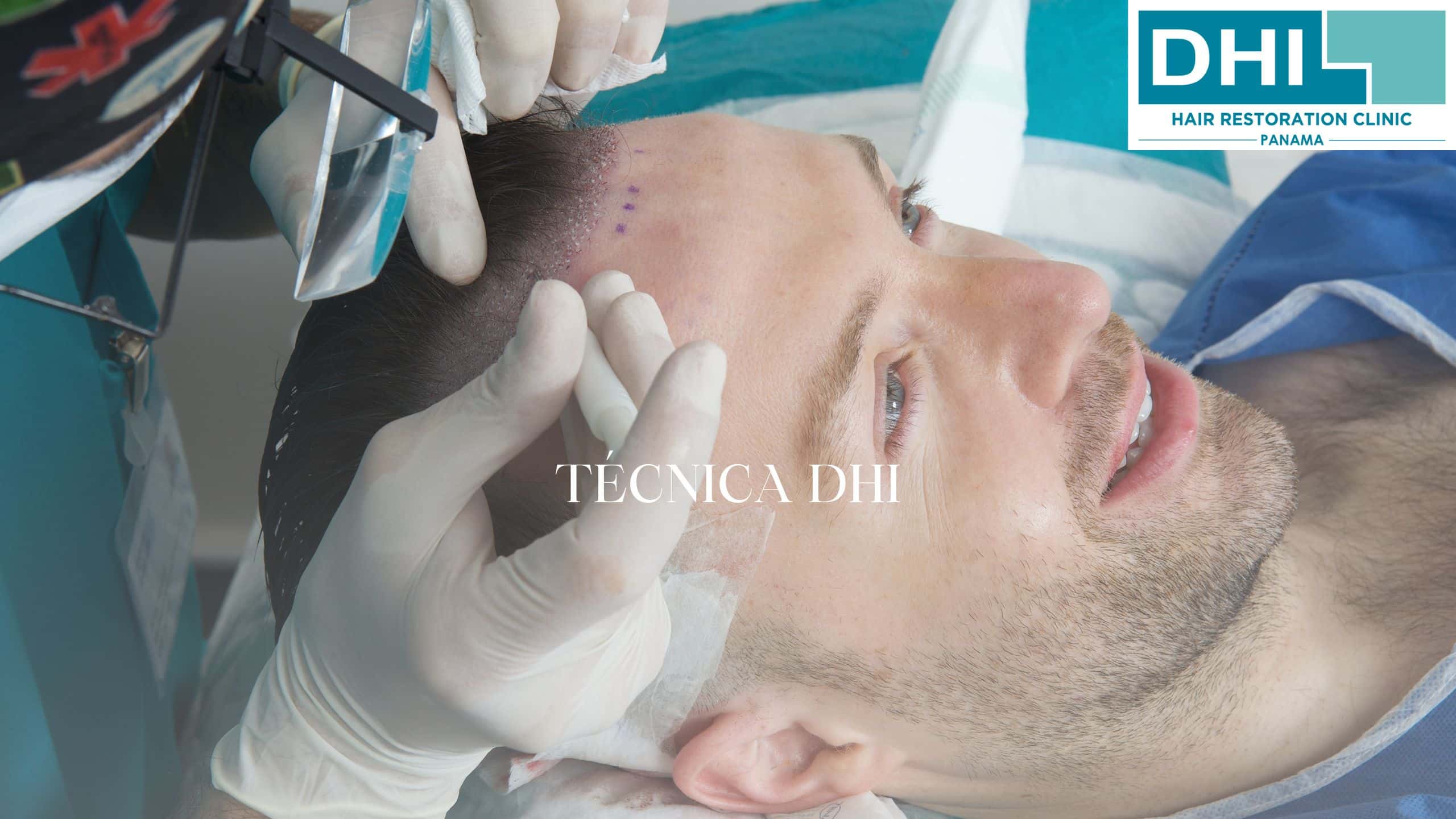 Técnica DHI en Panamá. Tecnología DHI para Trasplante de Cabello